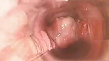 VİNTAGE DRECKSAU amator anal sikis 77
